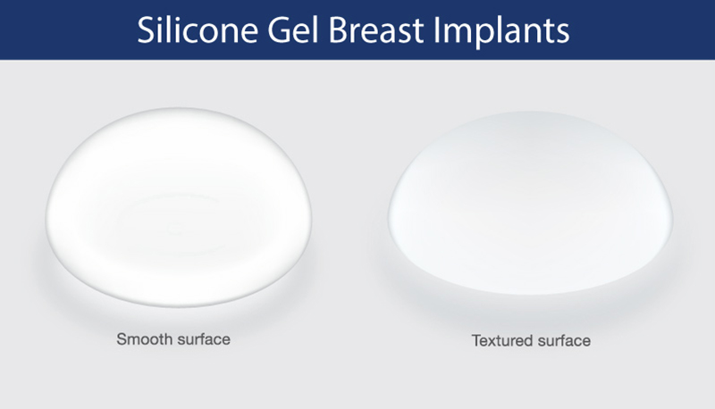 Safe Breast Augmentation Using Implants in Thailand - Page 2